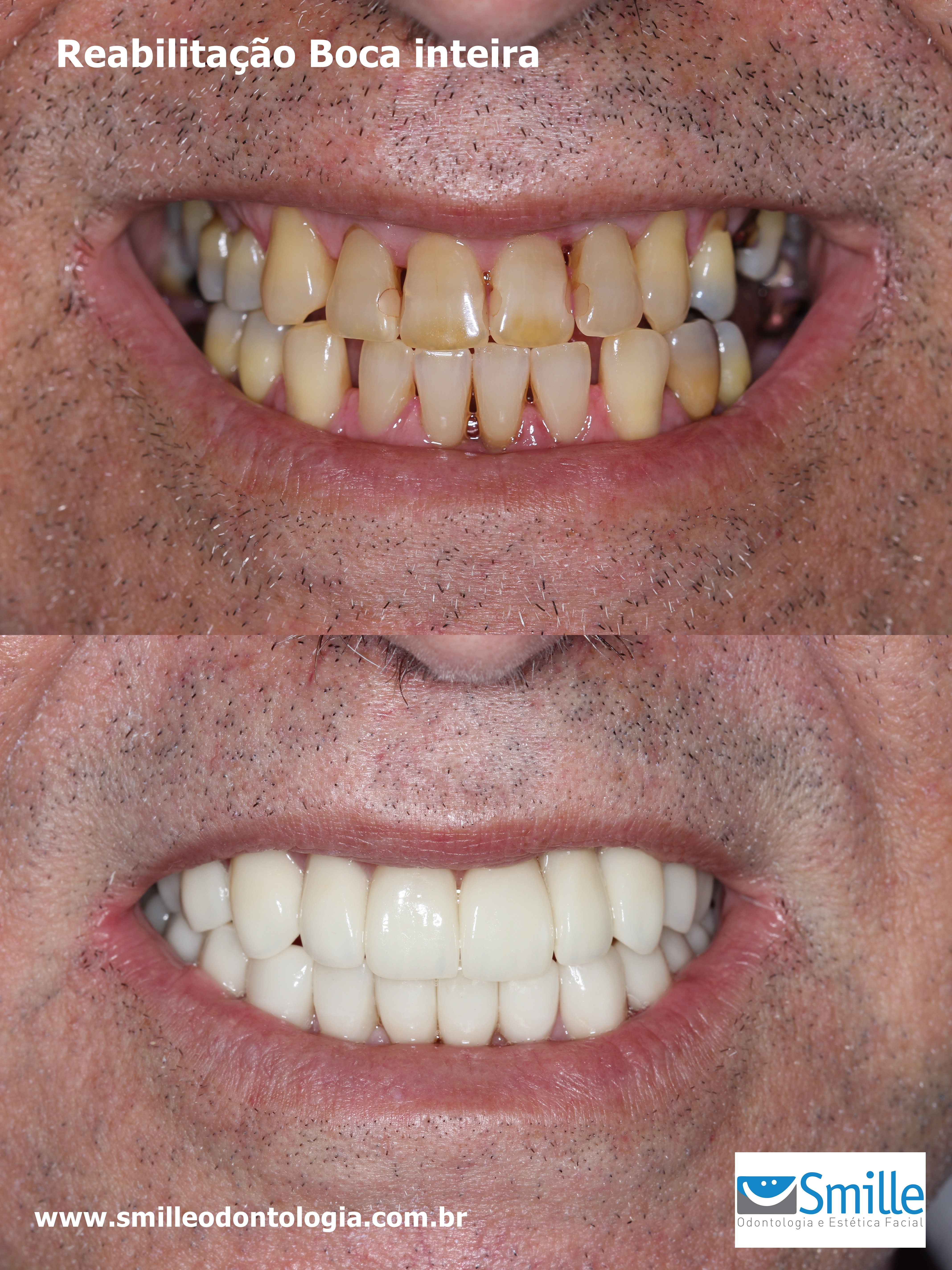 Caso Clínico Ailton