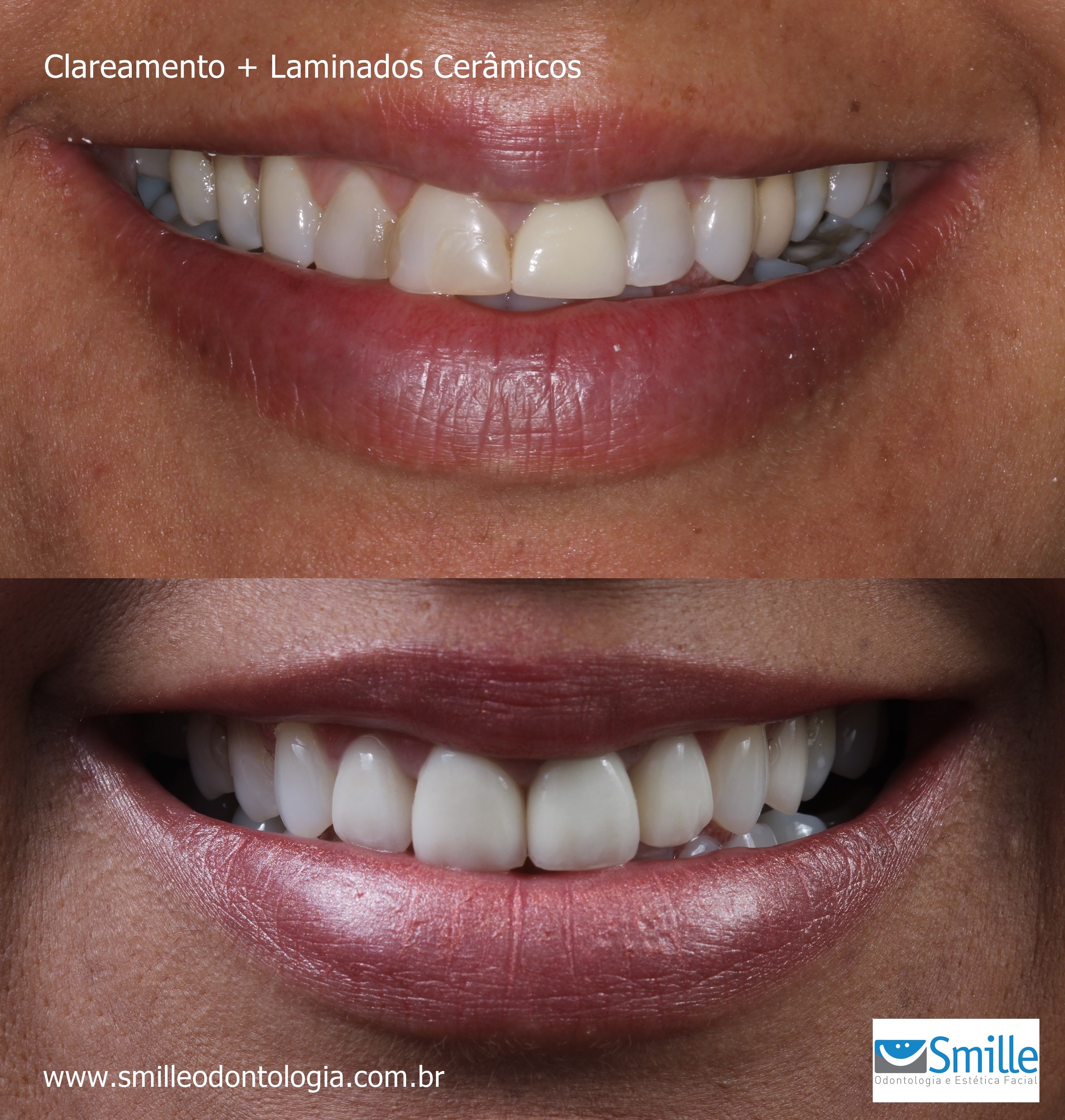 Caso Clínico Viviane